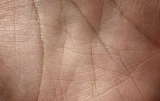 How to Prevent Wrinkles and Top Global Brands