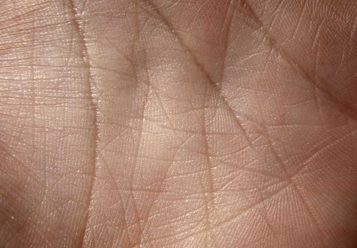 How to Prevent Wrinkles and Top Global Brands