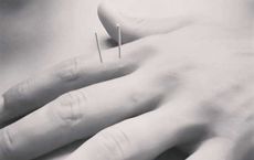 All about acupuncture