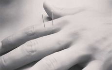 All About Acupuncture information education